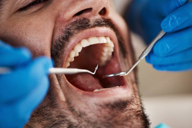 Best Dental Exams and Cleanings  in Chapel Hill, NC